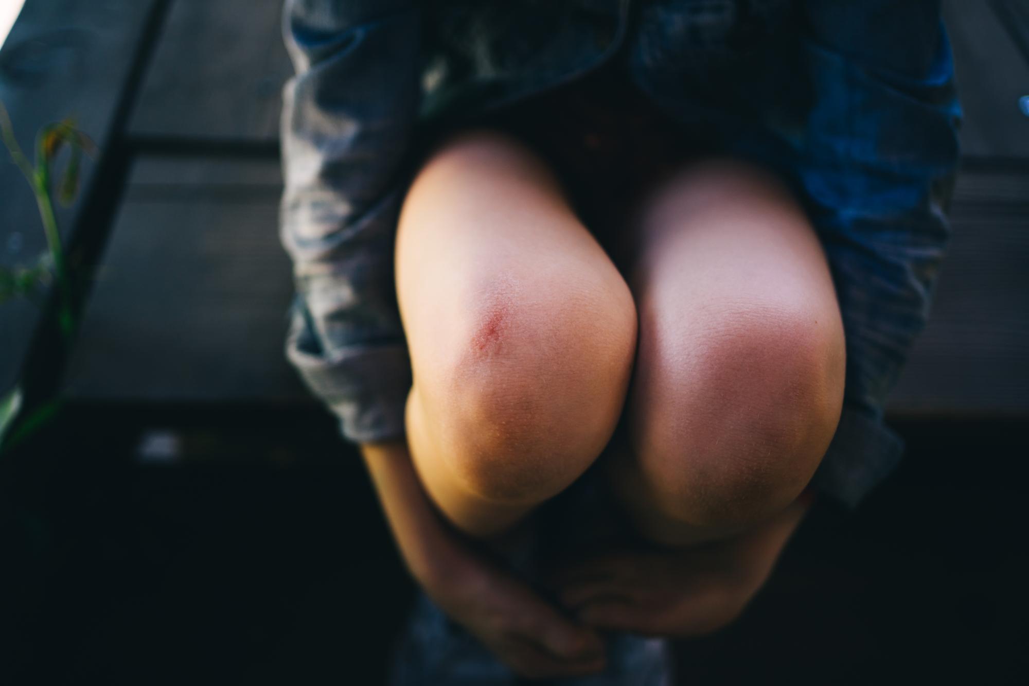 Comment reconnaître une infection aux oxyures ?