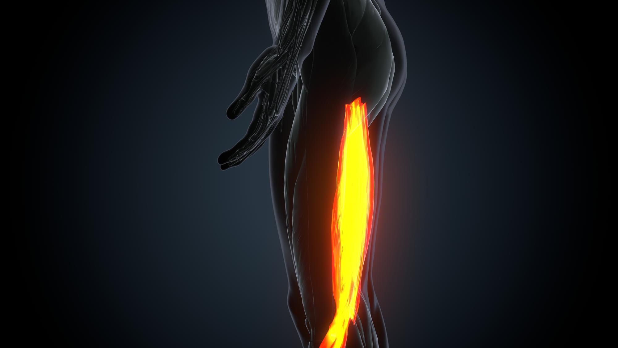 Douleur derrière la cuisse : quelles causes les plus fréquentes ?