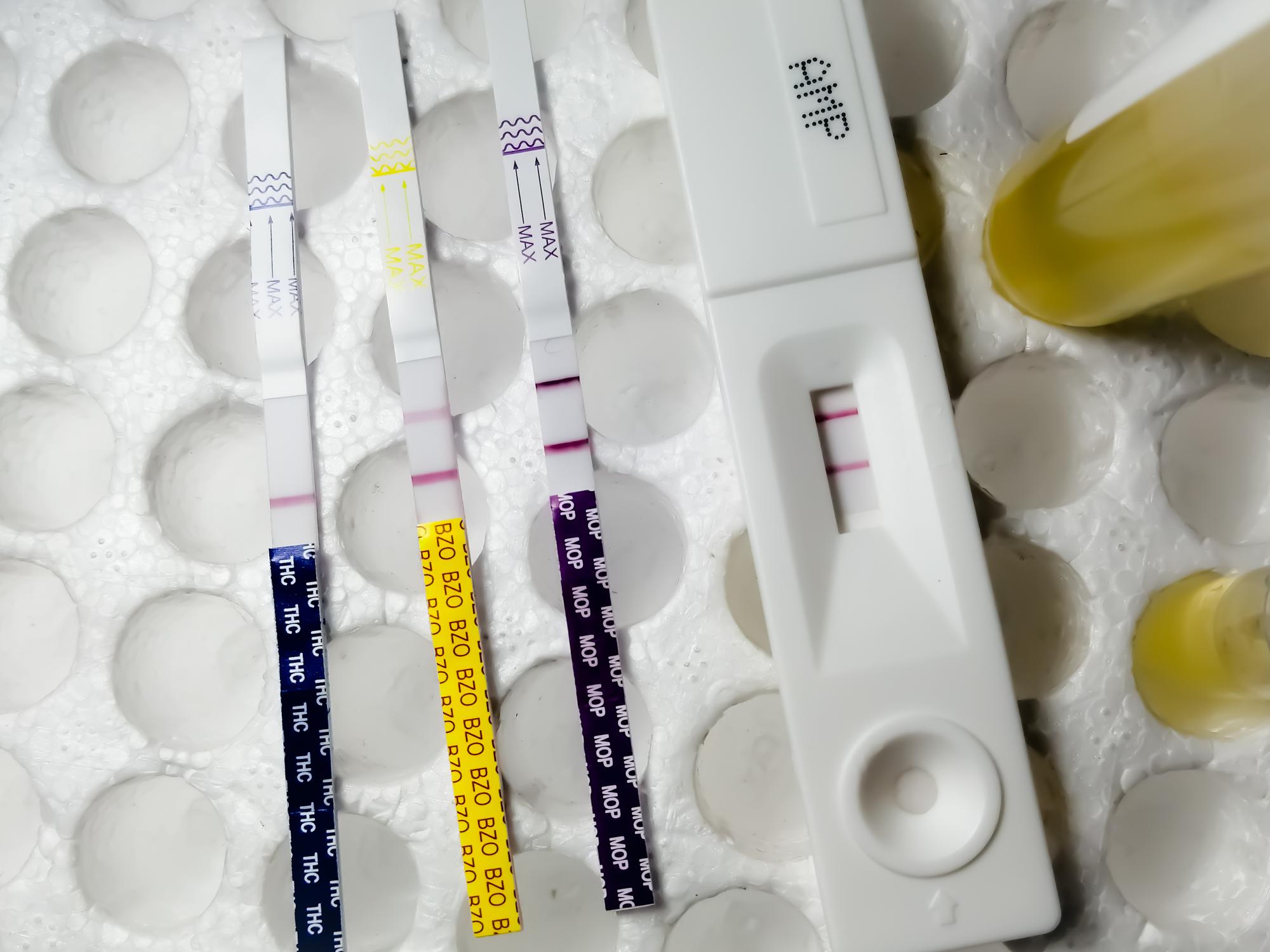 Quand une odeur d’urine doit vraiment alerter ?